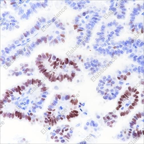 Recombinant SOX2 Monoclonal Antibody - 2