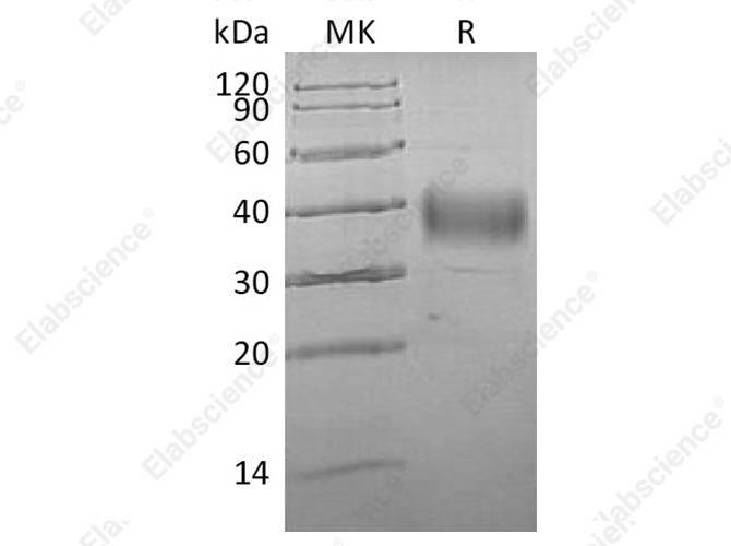 Recombinant Human ASGR1/ASGPR1 Protein (His Tag) - 1