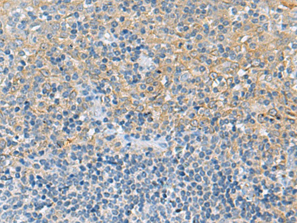 Immunohistochemistry of paraffin-embedded Human tonsil tissue  using LRAT Polyclonal Antibody at dilution of 1:55(?200)