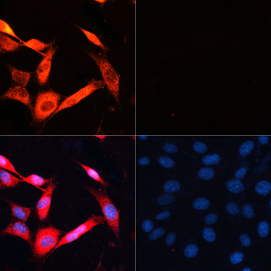 Immunofluorescence analysis of NIH/3T3 cells using P70 S6K Polyclonal Antibody at dilution of 1:100.NIH/3T3 cells were treated by Serum-starvation overnight at 37°C. Blue:DAPI for nuclear staining.