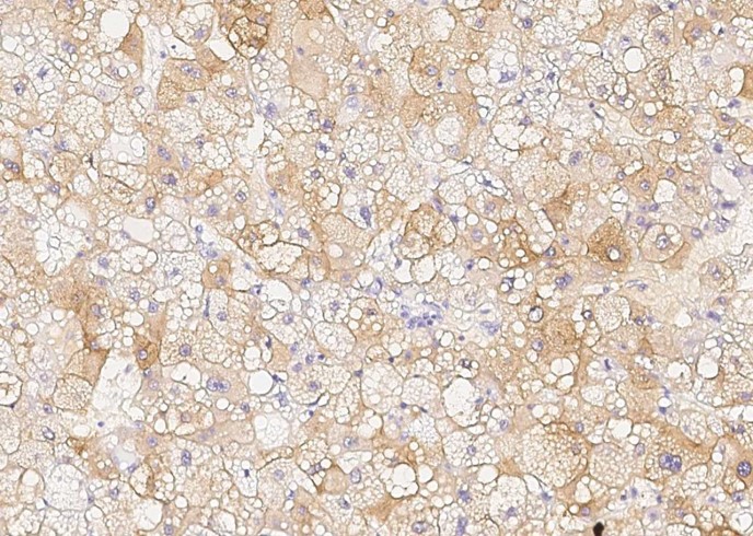 Recombinant chordin Monoclonal Antibody - small - 2