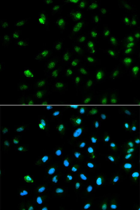 Immunofluorescence analysis of HepG2 cells using POLR2A Polyclonal Antibody