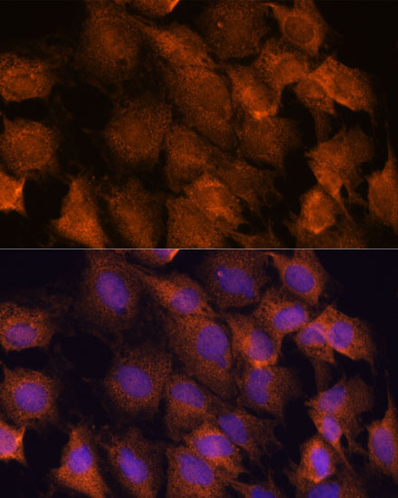 Immunofluorescence analysis of C6 cells using SCRN3 Polyclonal Antibody at dilution of  1:100. Blue: DAPI for nuclear staining.