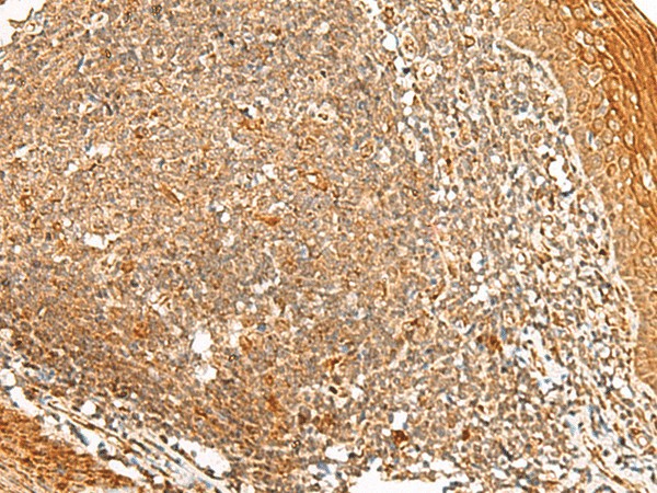 Immunohistochemistry of paraffin-embedded Human tonsil tissue  using PPOX Polyclonal Antibody at dilution of 1:45(?200)