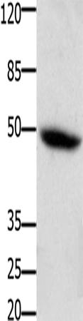 Western Blot analysis of Mouse heart tissue using CD116 Polyclonal Antibody at dilution of 1:400