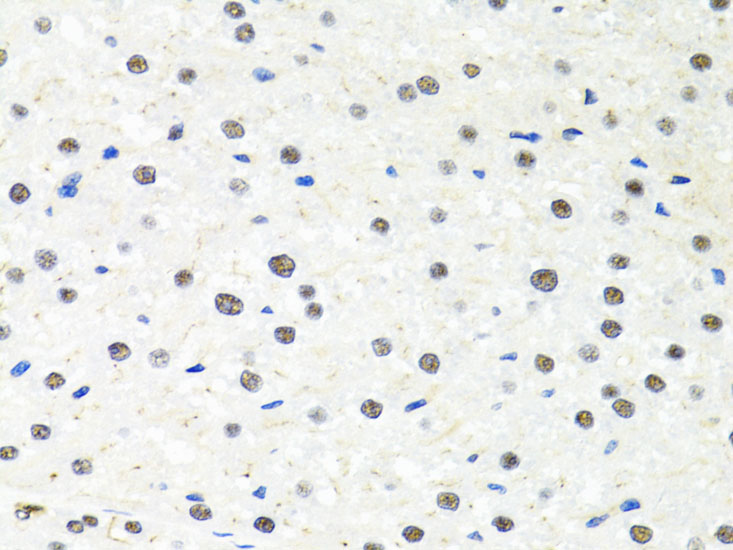 Immunohistochemistry of paraffin-embedded rat liver using PPP4C Polyclonal Antibody at dilution of 1:100 (40x lens).Perform microwave antigen retrieval with 10 mM PBS buffer pH 7.2 before commencing with IHC staining protocol.