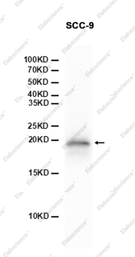 Recombinant Caveolin 2 Monoclonal Antibody - 2