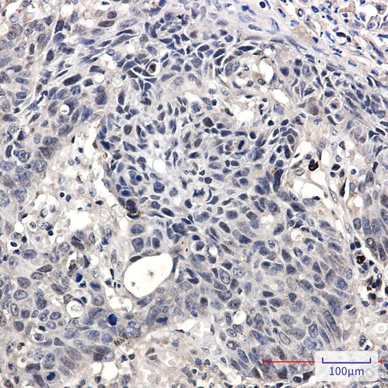 Recombinant SMARCA2 Monoclonal Antibody - 3
