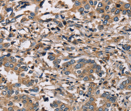 HSD17B12 Polyclonal Antibody - 3