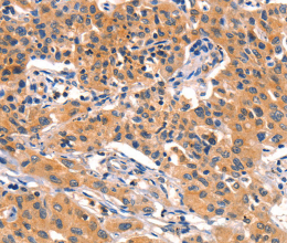 AMY2A Polyclonal Antibody - 2