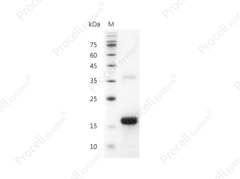 IL-2/TCGF/Aldesleukin, Mouse, Recombinant