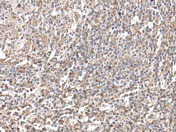 Immunohistochemistry of paraffin-embedded Human tonsil tissue  using GNAI2 Polyclonal Antibody at dilution of 1:25(?200)