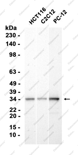 Recombinant Phospho-S6 Ribosomal Protein (Ser240, 244) Monoclonal Antibody - 1