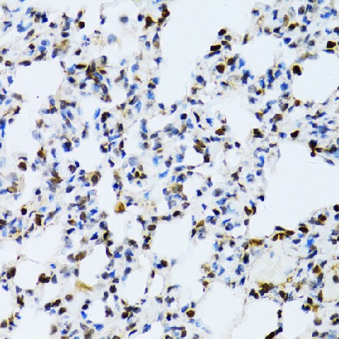 Immunohistochemistry of paraffin-embedded Rat lung using MAPK3 Polyclonal Antibody at dilution of  1:100 (40x lens).