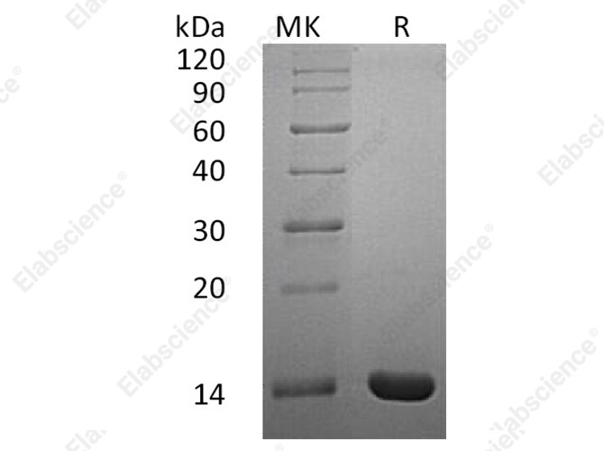 Recombinant Human Interleukin-2/IL-2 Protein (His Tag) - 1