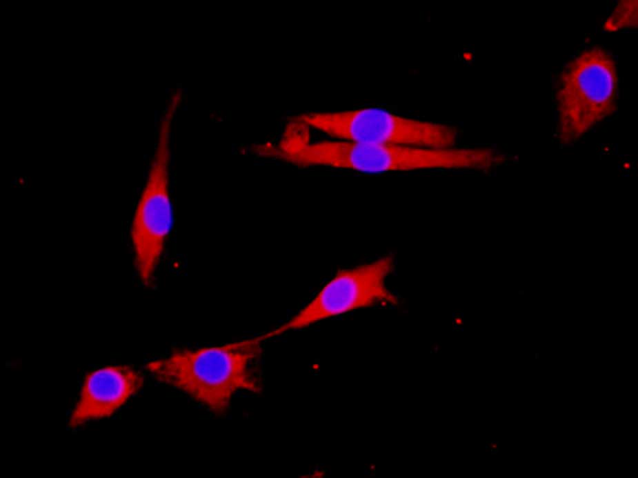 Purified Anti-Mouse CD274/PD-L1 Antibody[10F.9G2]-产品推荐-1