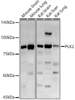 Western blot analysis of extracts of various cell lines using PLK2 Polyclonal Antibody at 1:1000 dilution.