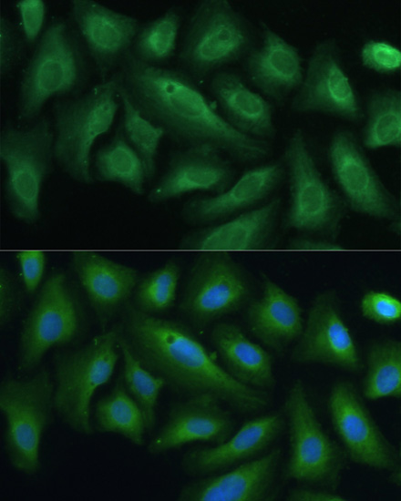 Immunofluorescence analysis of U-2 OS cells using PTPN22 Polyclonal Antibody at dilution of 1:100. Blue: DAPI for nuclear staining.
