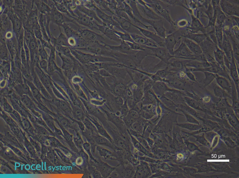 Human Lung Fibroblast (Primary cell immortalization) Complete Medium - 5