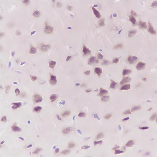 Recombinant eEF1G Monoclonal Antibody - small - 4