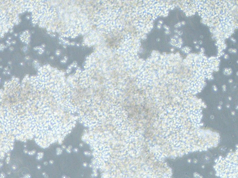 NCI-H2171 Cell Complete Medium - 9