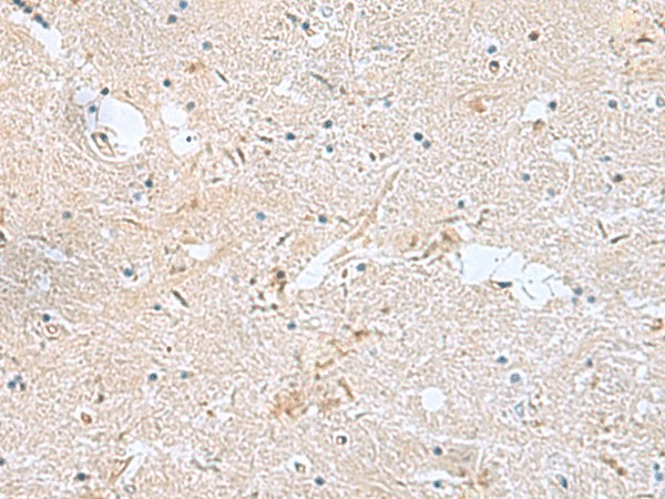 Immunohistochemistry of paraffin-embedded Human brain tissue  using FAM107B Polyclonal Antibody at dilution of 1:160(?200)