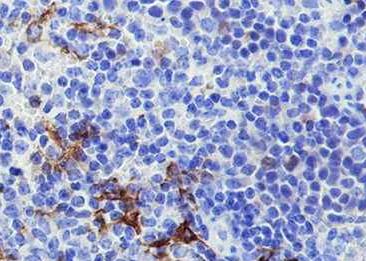 Recombinant MARCO Monoclonal Antibody-searchlist-2