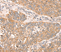 RPS6KA1 Polyclonal Antibody - 3
