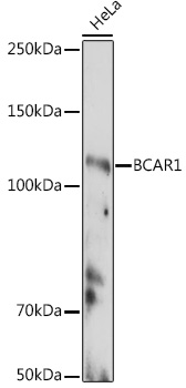 Western blot analysis of extracts of HeLa cells using BCAR1 Polyclonal Antibody at 1:500 dilution.