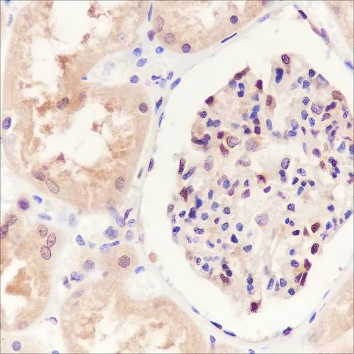 Recombinant SBDS Monoclonal Antibody - small - 3