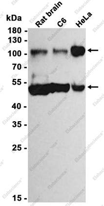Recombinant ORP1 Monoclonal Antibody - 1