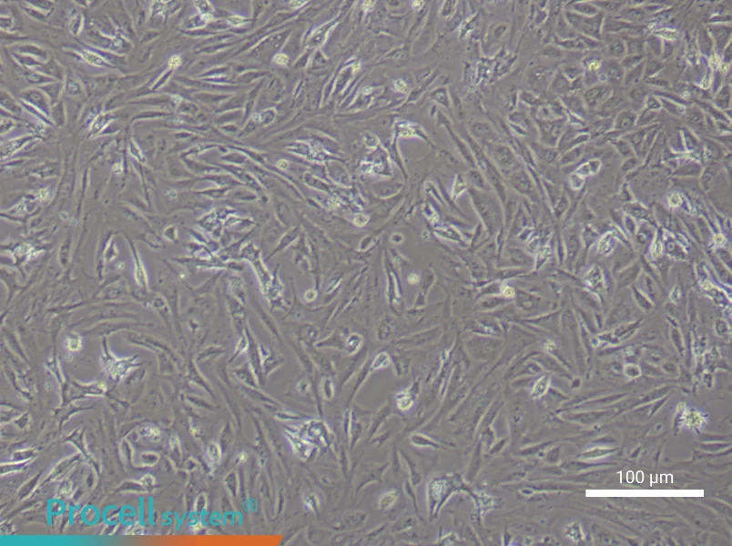 Mouse  Follicle Membrane Cell Complete Medium - 2