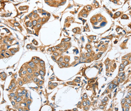 CAPG Polyclonal Antibody - 2