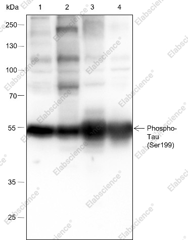 Recombinant Phospho-Tau (Ser199) Monoclonal Antibody - 1
