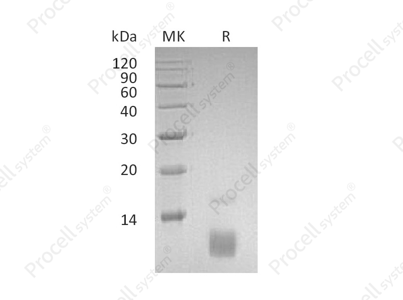 RANTES/CCL5, Human, Recombinant
