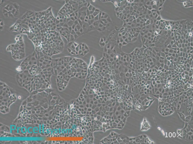 MKN74 Cell Complete Medium - 1