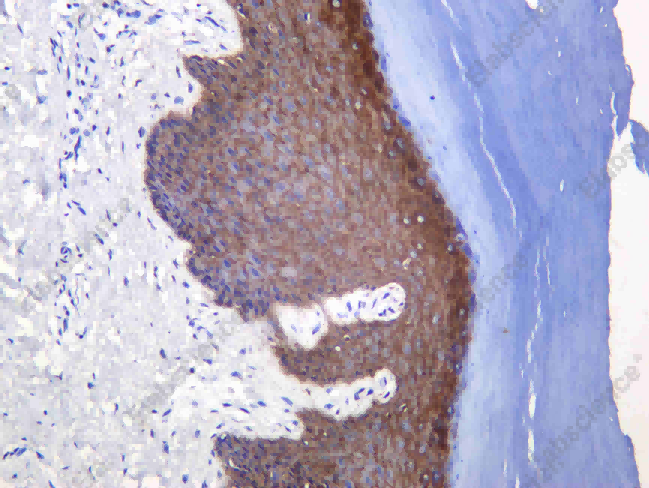 Recombinant 14 3 3σ Monoclonal Antibody - 1