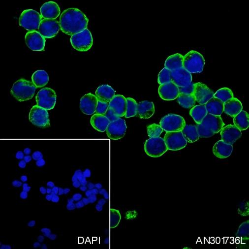 Recombinant CCR7 Monoclonal Antibody - 2
