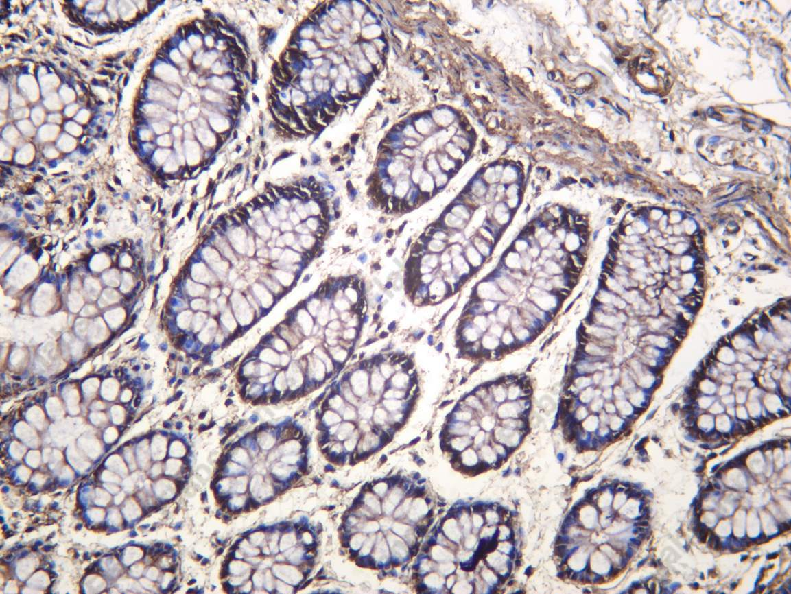 Recombinant ICAD Monoclonal Antibody - 1