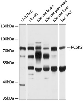 Western blot analysis of extracts of various cell lines using PCSK2 Polyclonal Antibody at 1:1000 dilution.