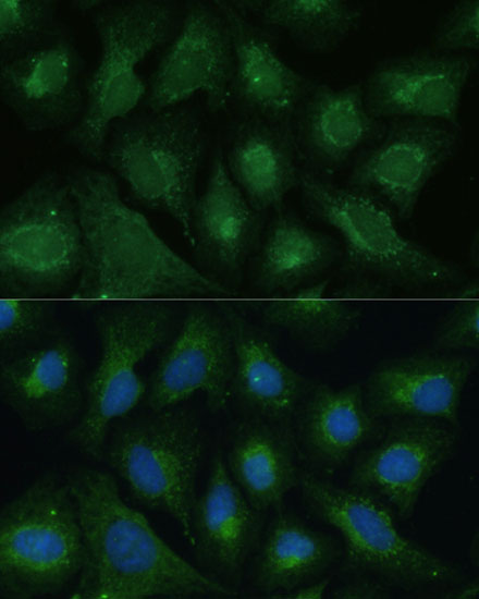 Immunofluorescence analysis of U2OS cells using DKK3 Polyclonal Antibody at dilution of 1:100. Blue: DAPI for nuclear staining.