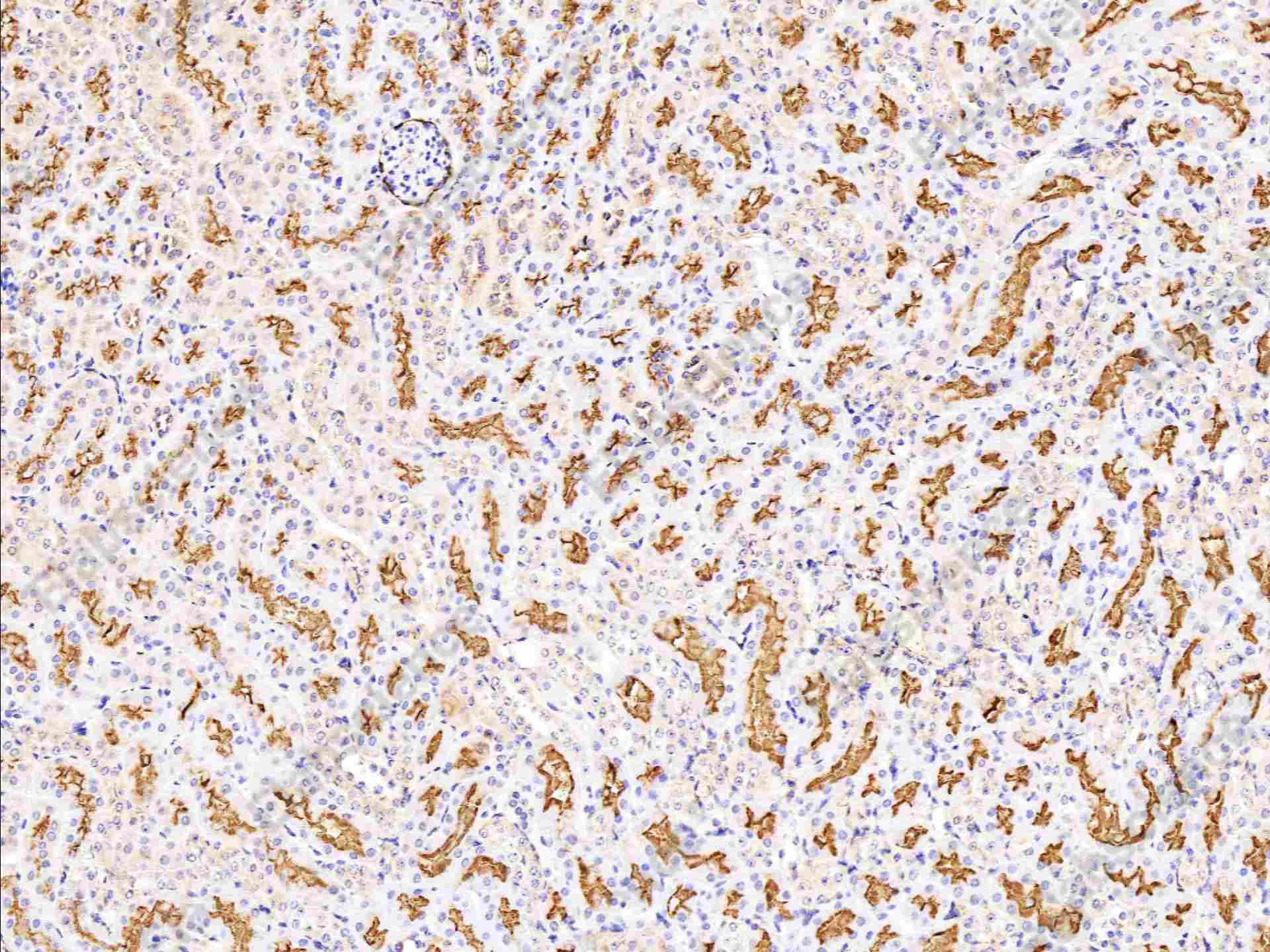 Recombinant CD13/ANPEP Monoclonal Antibody - 1