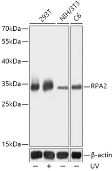 Western blot analysis of extracts of various cell lines using RPA2 Polyclonal Antibody at 1:1000 dilution. 293T cells were treated by UV at room temperature for 15-30 minutes.