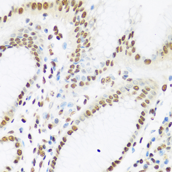 Immunohistochemistry of paraffin-embedded Human stomach using XRCC5 Polyclonal Antibody at dilution of 1:100 (40x lens).