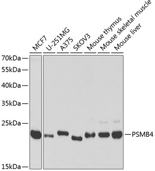 Western blot analysis of extracts of various cell lines using PSMB4 Polyclonal Antibody at 1:1000 dilution.