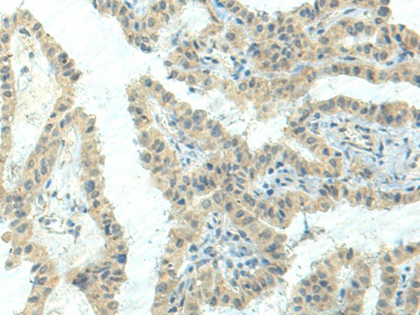 NPVF Polyclonal Antibody - small - 2