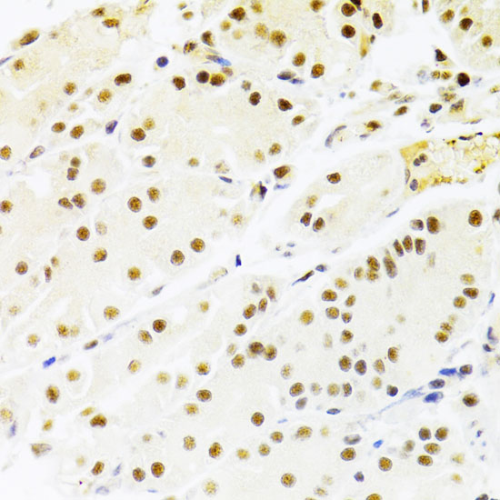 Immunohistochemistry of paraffin-embedded human stomach using RBPJKK Polyclonal antibody at dilution of 1:100 (40x lens).Perform microwave antigen retrieval with 10 mM PBS buffer pH 7.2 before commencing with IHC staining protocol.