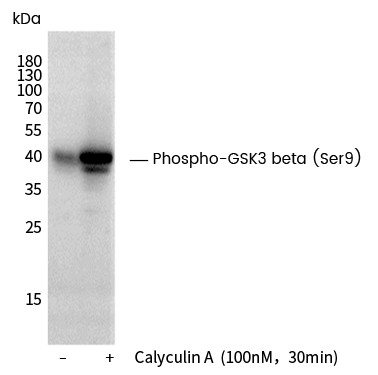 Recombinant Phospho-GSK3 beta (Ser9) Monoclonal Antibody - small - 2