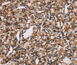 NDUFS1 Polyclonal Antibody - 2