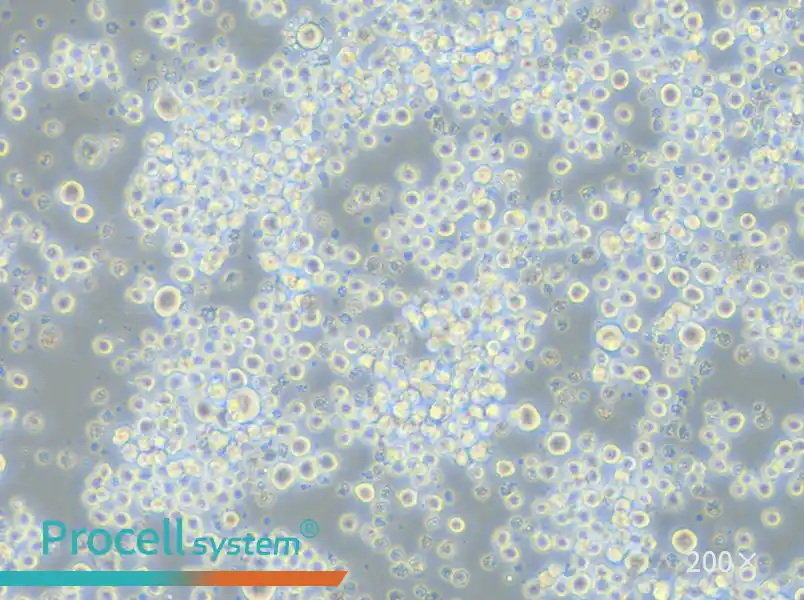 P3X63Ag8.653 Cell Complete Medium - 6